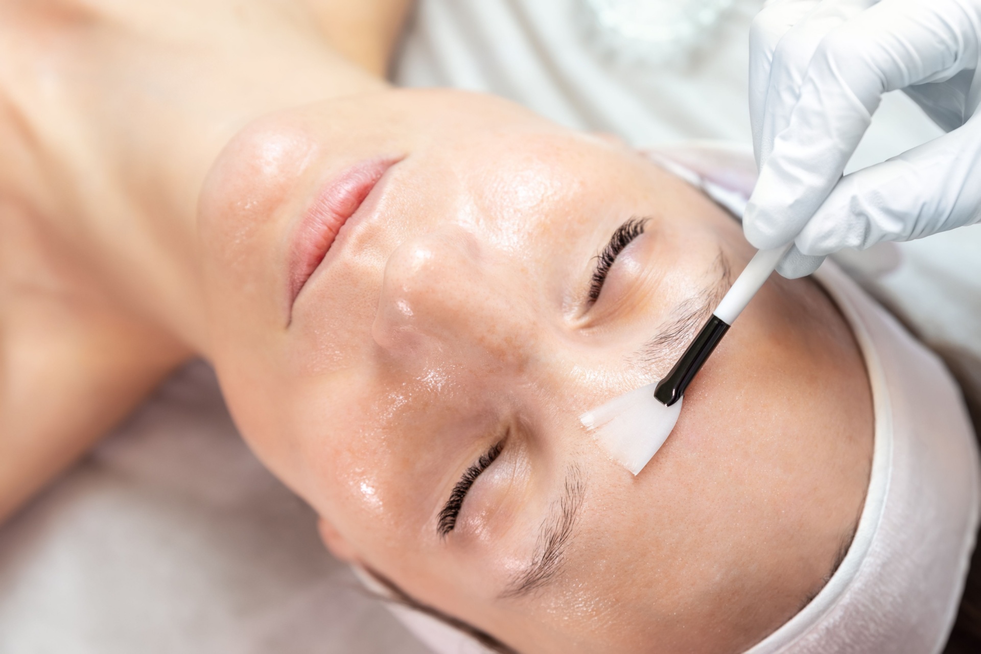 Kvinne får ZO Stimulator Peel behandling